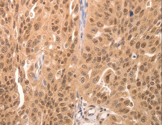 AP-1 / JUND Antibody