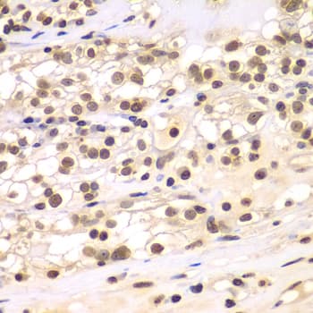 ULK4 Antibody