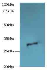 ODF3L1 Antibody