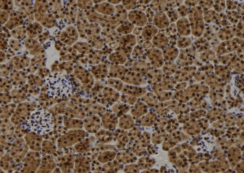 Polyclonal Rabbit anti-Human RB1CC1 / CC1 Antibody (IHC, WB)