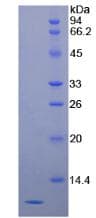Human SERPINB4 / SCCA1+2 Protein (Recombinant His)