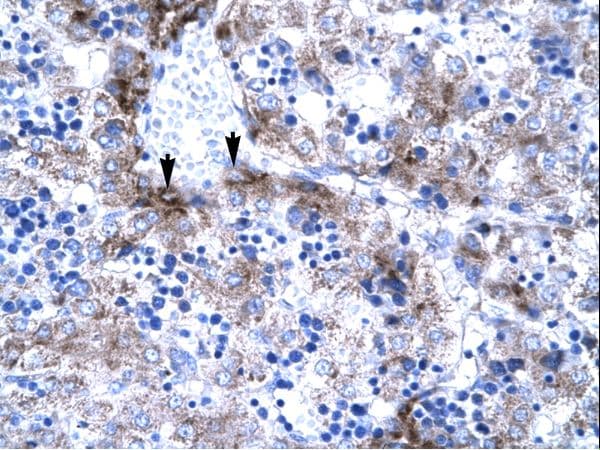 SUB1 Antibody (aa62-111)