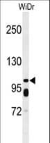 ABCC11 / MRP8 Antibody (aa343-372)