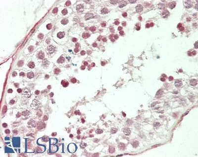 IHC-plus™ TFE3 Antibody