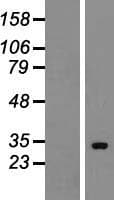HUS1B Protein (Over-Expression Lysate Myc-DDK (Flag))