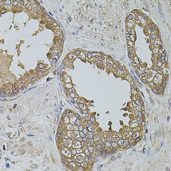 Polyclonal Rabbit anti-Human KTN1 / Kinectin Antibody (IHC, WB)