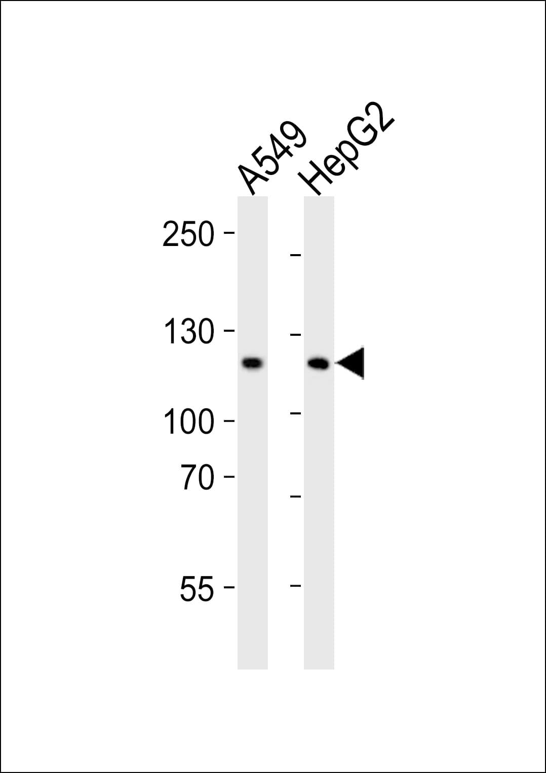 CARD6 Antibody