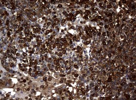NME1 / NM23 Antibody (clone OTI4H2)