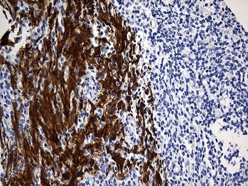 Monoclonal Mouse anti-Human TRIM29 Antibody (clone OTI8D12, aa1-352, IHC, WB)