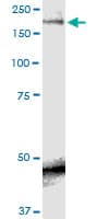 SCN9A / Nav1.7 Antibody (clone 5A11)