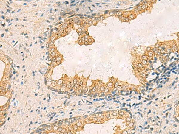 Polyclonal Rabbit anti-Human HORMAD2 Antibody (IHC)