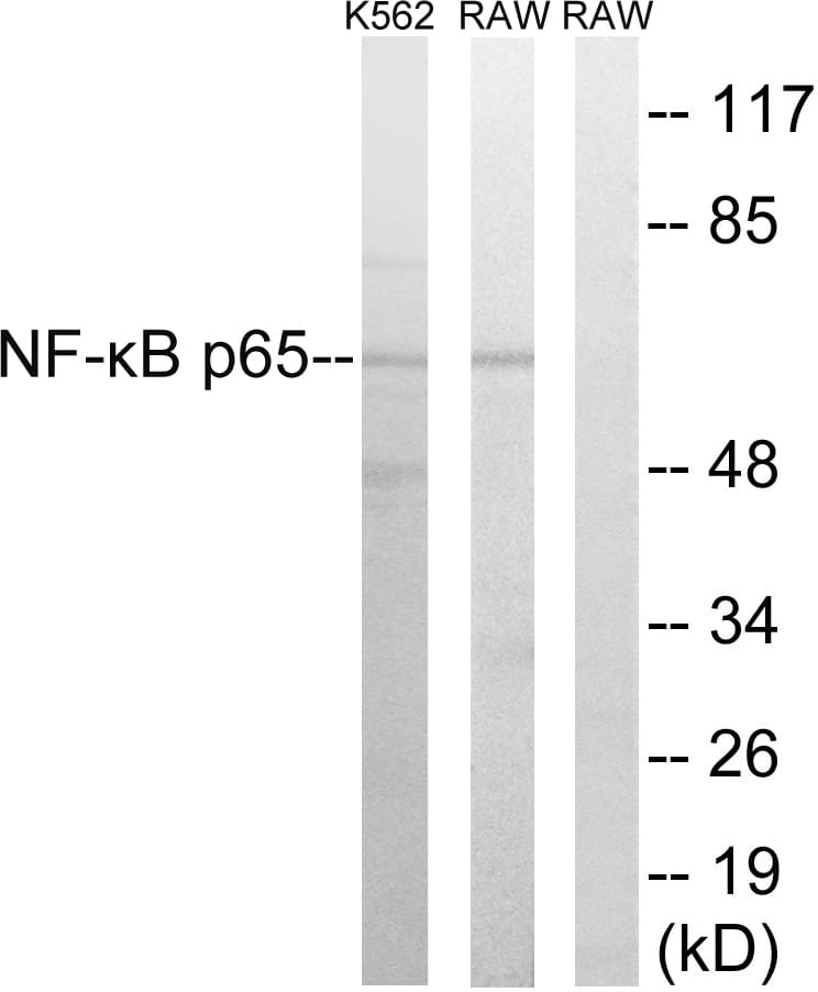 RELA / NFKB p65 Antibody (aa249-298)