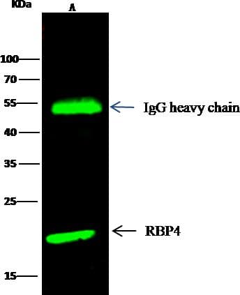 Polyclonal Rabbit anti-Human RBP4 Antibody (Preservative Free, IHC, WB)