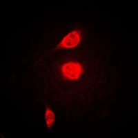 ATF1 Antibody (C-Terminus)