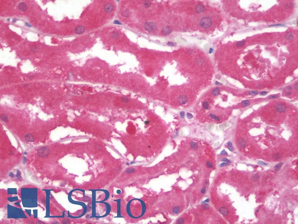 IHC-plus™ JAKMIP2 Antibody