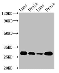 SFN / Stratifin / 14-3-3 Sigma Antibody