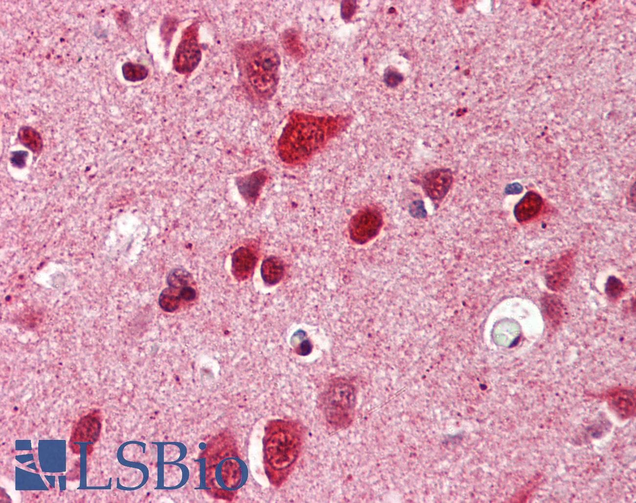 IHC-plus™ Ubiquitin Antibody (clone P4G7-H11)