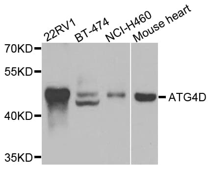 ATG4D Antibody