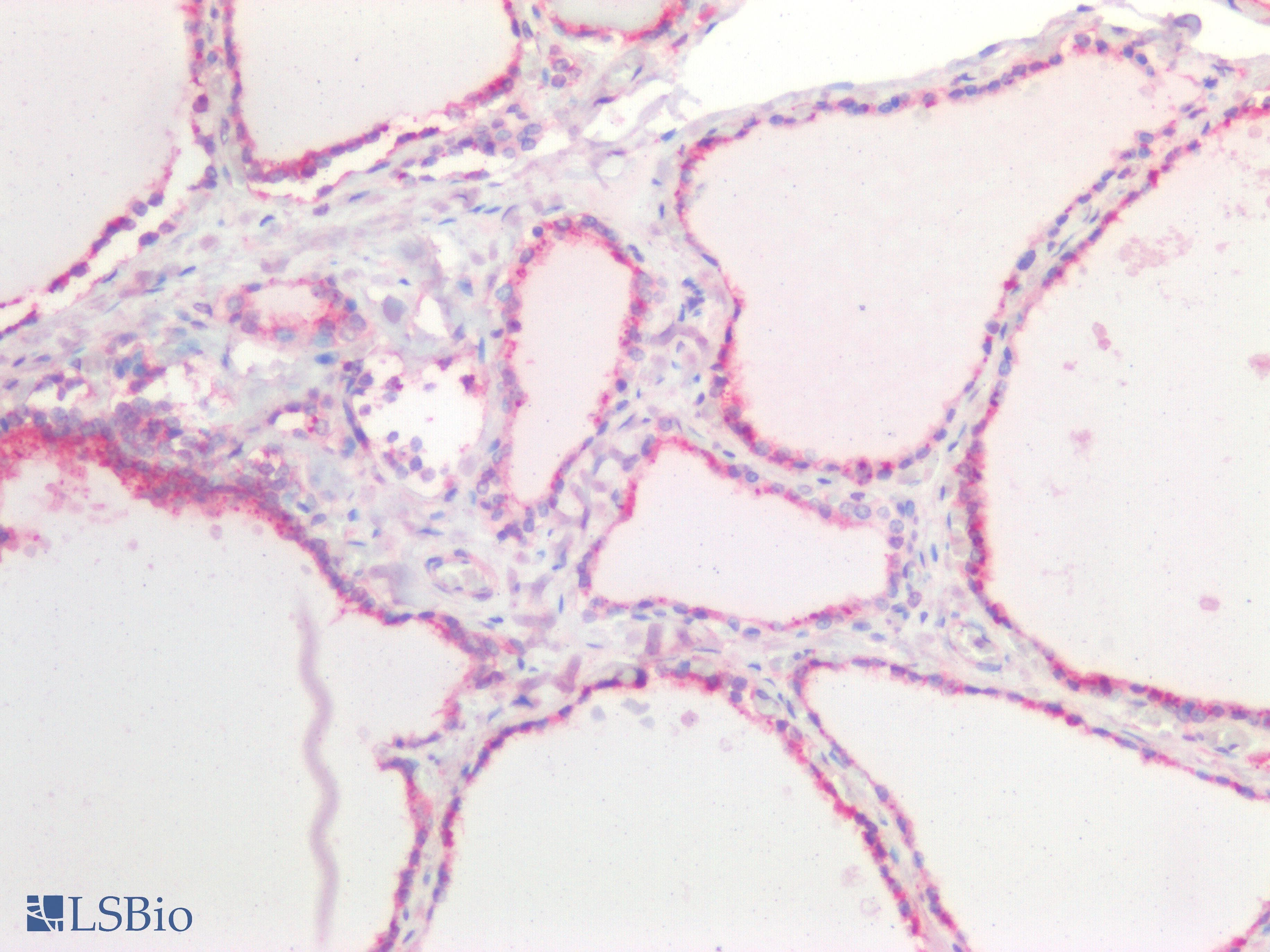 IHC-plus™ Polyclonal Goat anti-Human CDH1 / E Cadherin Antibody (aa662-675, IHC, WB)