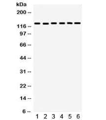 Polyclonal Rabbit anti-Human FAK / Focal Adhesion Kinase Antibody (WB)