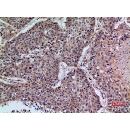 GP1BA / CD42b Antibody (261-310 aa, Internal)