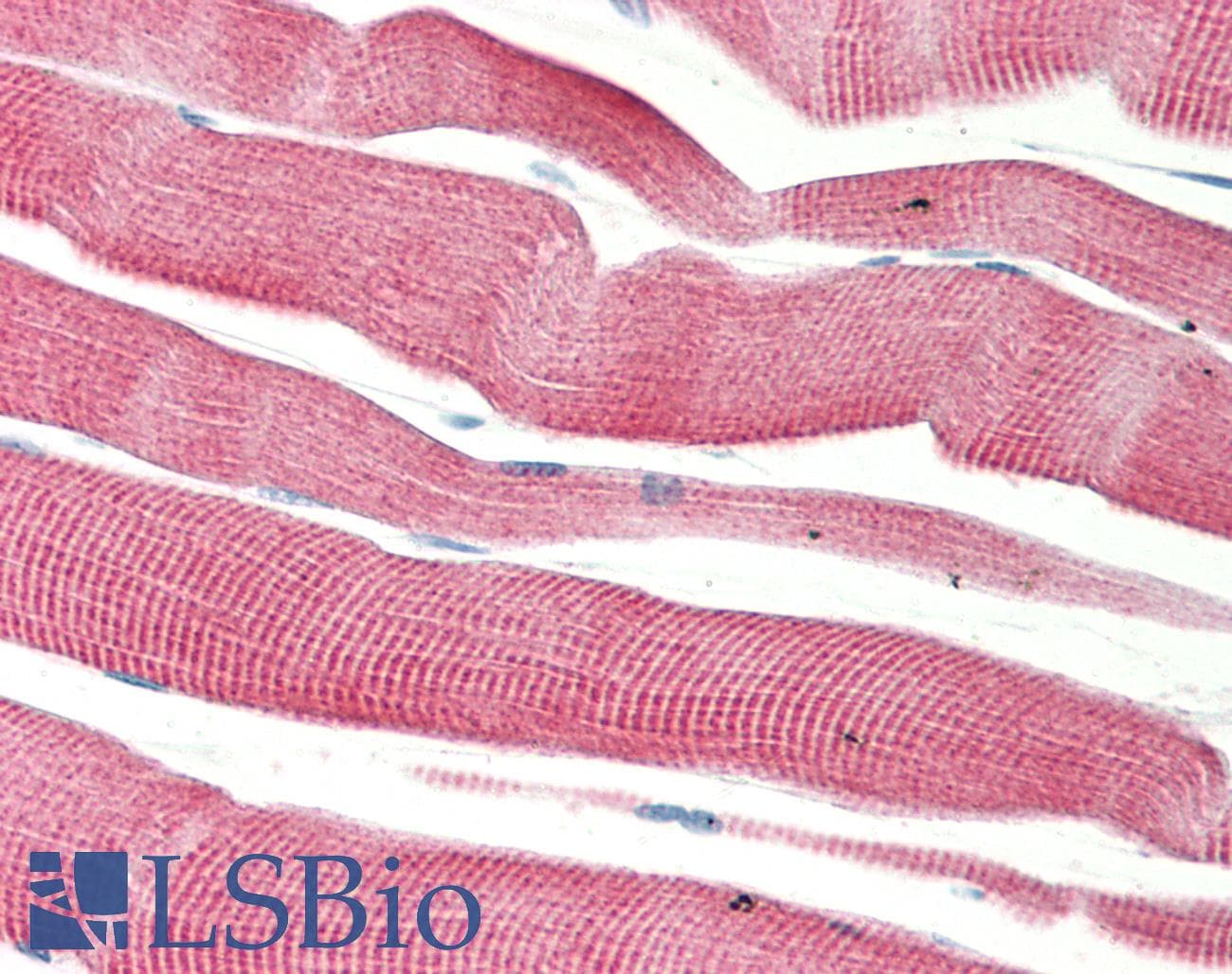 PathPlus™ Actin Antibody (clone ABT-ACTN)