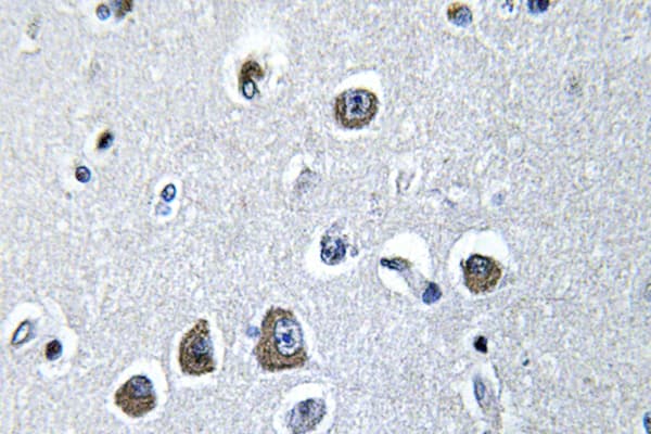 Polyclonal Rabbit anti-Human EIF3S5 / EIF3F Antibody (Val116, IHC, WB)