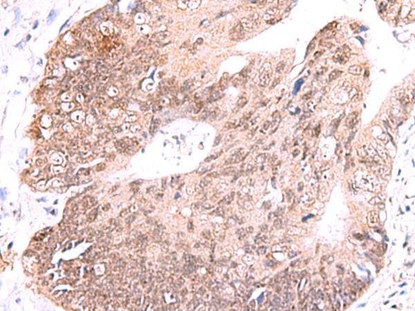 RUSC1 Antibody