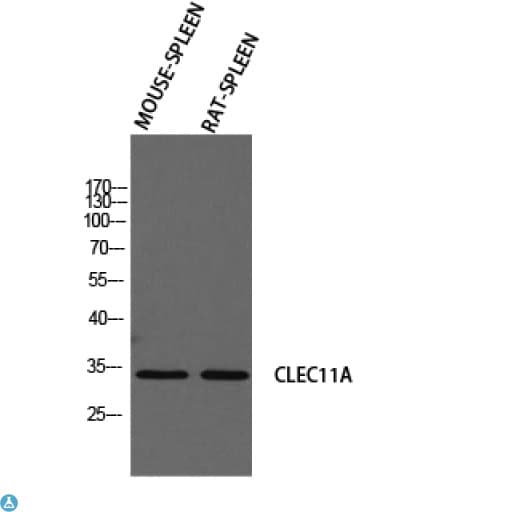 Polyclonal Rabbit anti-Human SCGF Antibody (IHC, WB)