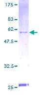 Human YWHAE / 14-3-3 Epsilon Protein (Recombinant GST)