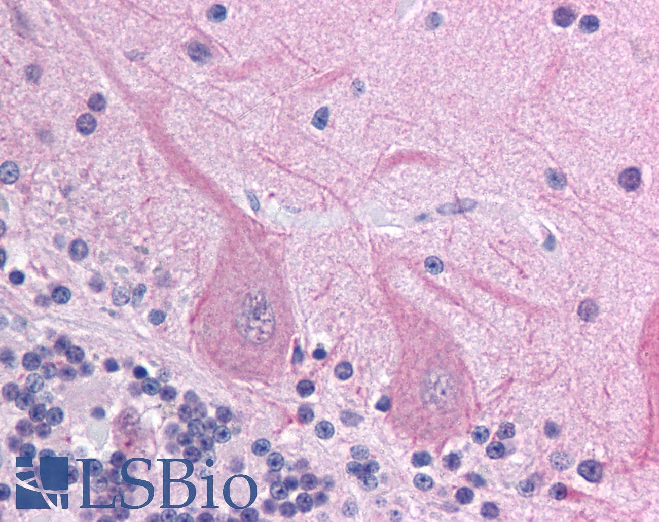 ACCN4 / ASIC4 Antibody (aa121-170)