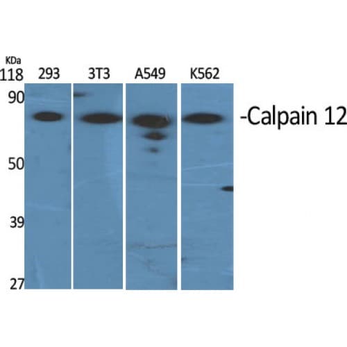 CAPN12 / Calpain 12 Antibody (190-270 aa, Internal)