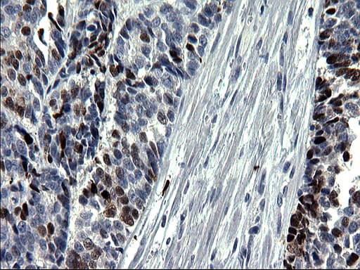 Monoclonal Mouse anti-Human SMAD1 Antibody (clone OTI1C5, IHC, WB)