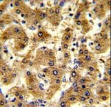 ADH2 / ADH1B Antibody (aa209-237)