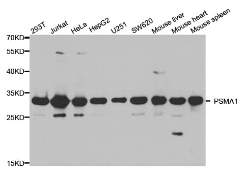 IHC-plus™ Polyclonal Rabbit anti-Human PSMA1 Antibody (IHC, IF, WB)