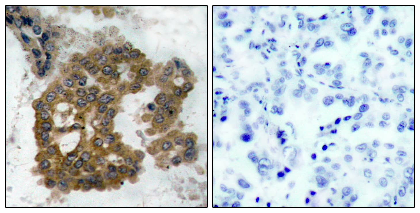 AKT2 Antibody (phospho-Ser474)