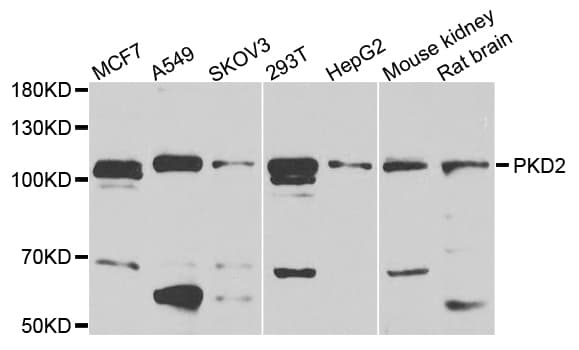 PKD2 / Polycystin 2 Antibody