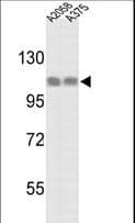 IHC-plus™ HSPH1 / HSP105 Antibody (aa717-745)