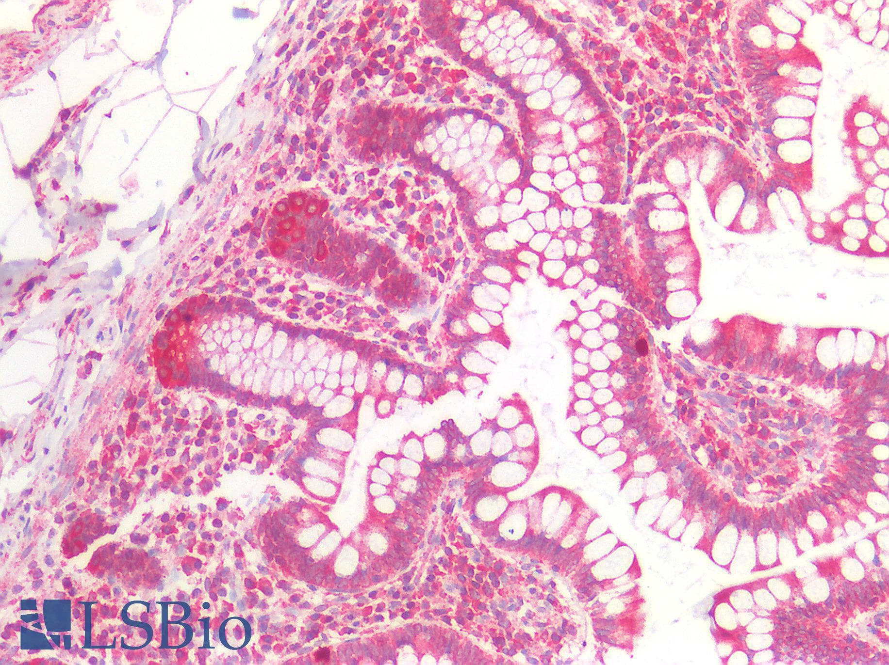 IHC-plus™ c-Maf Antibody