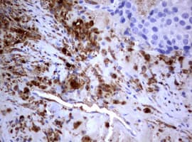 PIK3C2A Antibody (aa230-560, clone OTI3H2)