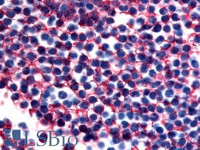 PathPlus™ Polyclonal Rabbit anti-Human GPR183 / EBI2 Antibody (Extracellular Domain, IHC)