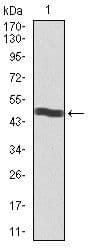 Monoclonal Mouse anti-Human CD5 Antibody (clone 6A11, Amino Acid: 27-233, WB)