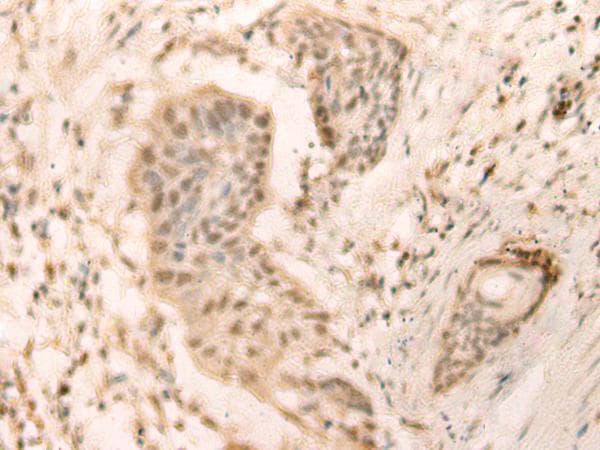 Polyclonal Rabbit anti-Human ELP4 Antibody (IHC)