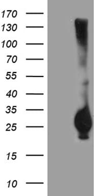Monoclonal Mouse anti-Human RGS17 / RGSZ2 Antibody (clone OTI6G3, IHC, WB)