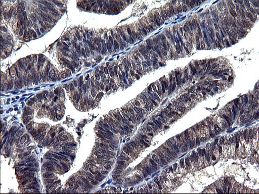 TXNDC5 / ERP46 Antibody (clone OTI2E6)