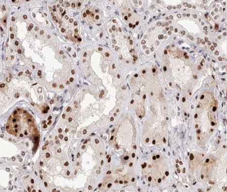 NFKB2 Antibody (phospho-Ser865)