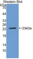 CRYBB2 Antibody (APC, Cy7)