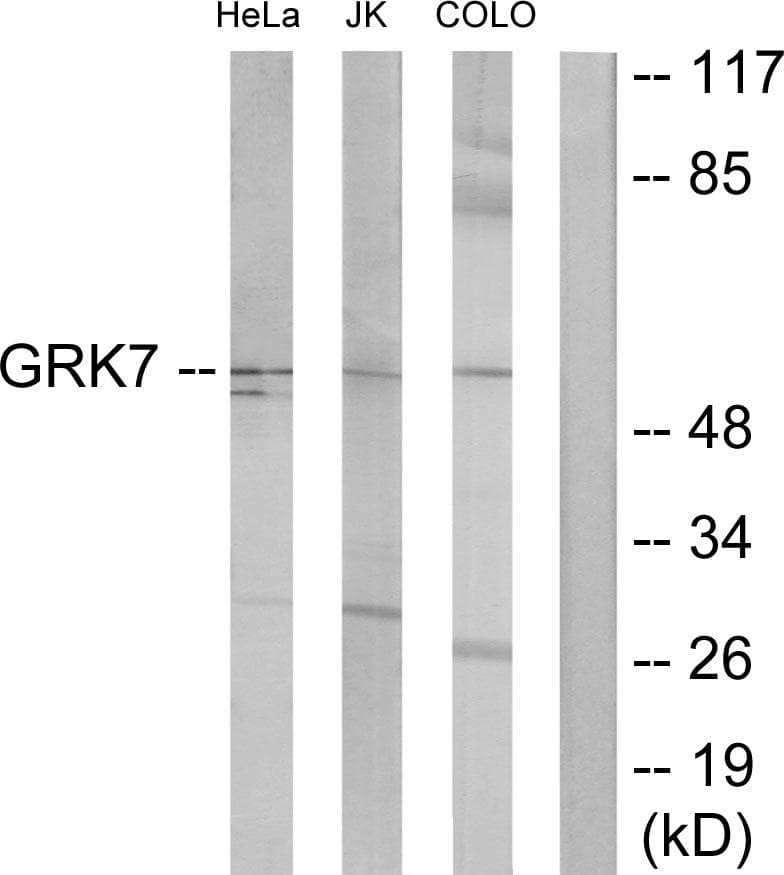 GRK7 / GPRK7 Antibody