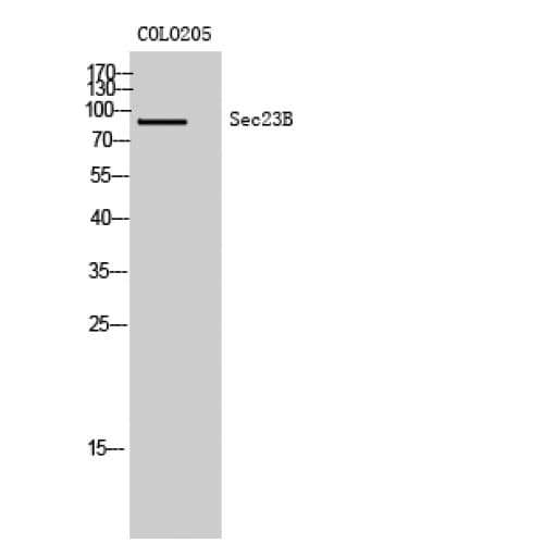 SEC23B Antibody (Internal)