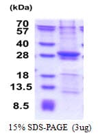 Human SIKE1 Protein (Recombinant His)